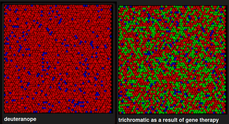 Retinal cone mosaic before and after gene therapy